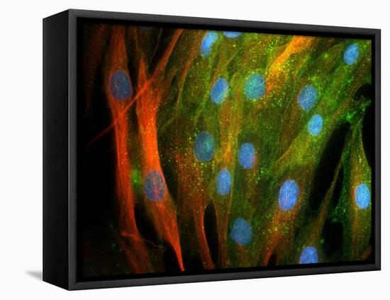 Adipose Stem Cells, Light Micrograph-Riccardo Cassiani-ingoni-Framed Stretched Canvas