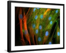 Adipose Stem Cells, Light Micrograph-Riccardo Cassiani-ingoni-Framed Photographic Print