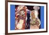 Adorn The Bride with Veil and Wreath-Gustav Klimt-Framed Premium Giclee Print