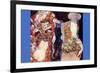 Adorn The Bride with Veil and Wreath-Gustav Klimt-Framed Art Print
