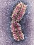 Human Chromosome 1, SEM-Adrian Sumner-Stretched Canvas