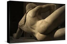 Aegina West Pediment. 500-490 BC. Detail of Fallen Trojan Warrior. Temple of Aphaia. Greece-null-Stretched Canvas