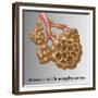 Alveoli with Emphysema-Gwen Shockey-Framed Giclee Print