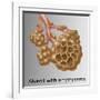 Alveoli with Emphysema-Gwen Shockey-Framed Giclee Print