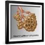 Alveoli with Emphysema-Gwen Shockey-Framed Giclee Print