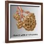 Alveoli with Emphysema-Gwen Shockey-Framed Giclee Print