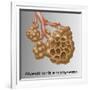 Alveoli with Emphysema-Gwen Shockey-Framed Giclee Print