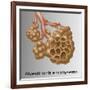 Alveoli with Emphysema-Gwen Shockey-Framed Giclee Print