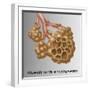 Alveoli with Emphysema-Gwen Shockey-Framed Giclee Print