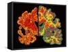 Alzheimer's Brain-PASIEKA-Framed Stretched Canvas