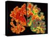 Alzheimer's Brain-PASIEKA-Stretched Canvas
