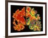 Alzheimer's Brain-PASIEKA-Framed Photographic Print