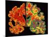 Alzheimer's Brain-PASIEKA-Mounted Photographic Print
