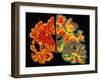 Alzheimer's Brain-PASIEKA-Framed Photographic Print