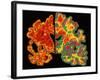 Alzheimer's Brain-PASIEKA-Framed Photographic Print