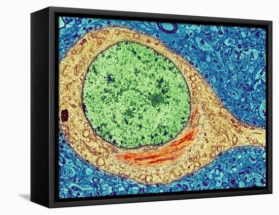 Alzheimer's Disease Brain Cell, TEM-Thomas Deerinck-Framed Stretched Canvas