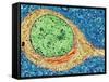 Alzheimer's Disease Brain Cell, TEM-Thomas Deerinck-Framed Stretched Canvas