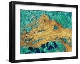 Alzheimer's Disease Brain Cell, TEM-Thomas Deerinck-Framed Photographic Print