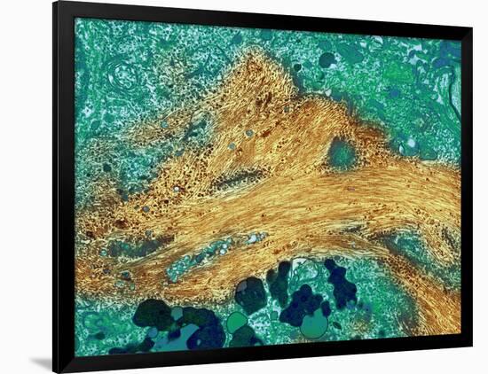 Alzheimer's Disease Brain Cell, TEM-Thomas Deerinck-Framed Photographic Print