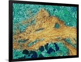 Alzheimer's Disease Brain Cell, TEM-Thomas Deerinck-Framed Photographic Print