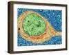 Alzheimer's Disease Brain Cell, TEM-Thomas Deerinck-Framed Photographic Print