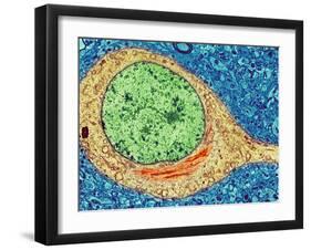 Alzheimer's Disease Brain Cell, TEM-Thomas Deerinck-Framed Photographic Print