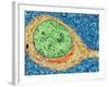 Alzheimer's Disease Brain Cell, TEM-Thomas Deerinck-Framed Photographic Print