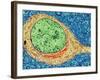 Alzheimer's Disease Brain Cell, TEM-Thomas Deerinck-Framed Photographic Print