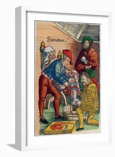 Amputation, Illustration from Feldtbuch Der Wundartzney by Hans Von Gersdorff, c.1540-Hans Or Johannes Ulrich Wechtlin-Framed Giclee Print