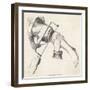 Amputation of Leg-null-Framed Art Print