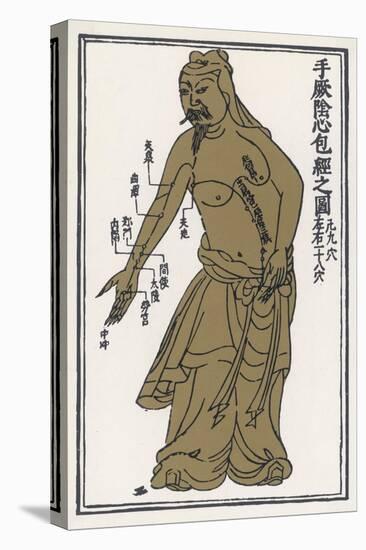 An Ancient Chinese Acupuncture Chart-T'ongjen Tschen Kieou King-Stretched Canvas