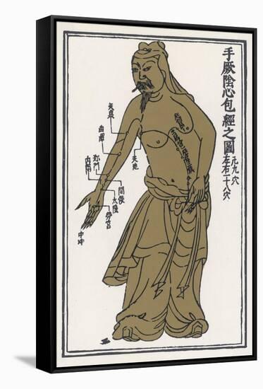 An Ancient Chinese Acupuncture Chart-T'ongjen Tschen Kieou King-Framed Stretched Canvas