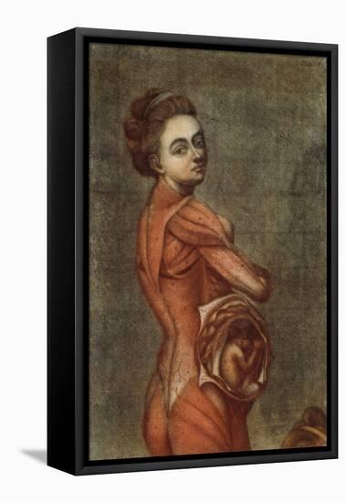 Anatomical Illustration in Colour of a Pregnant Female, 1778-Jacques-Fabien Gautier d'Agoty-Framed Stretched Canvas