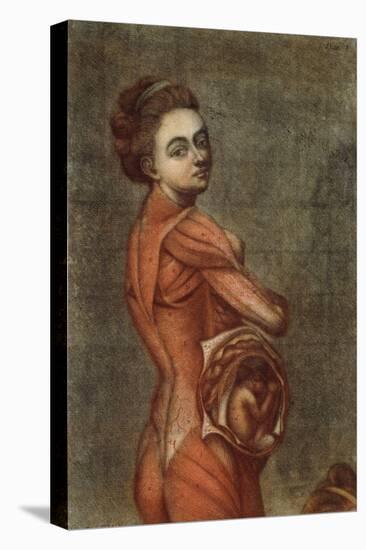 Anatomical Illustration in Colour of a Pregnant Female, 1778-Jacques-Fabien Gautier d'Agoty-Stretched Canvas