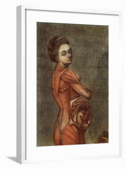 Anatomical Illustration in Colour of a Pregnant Female, 1778-Jacques-Fabien Gautier d'Agoty-Framed Giclee Print