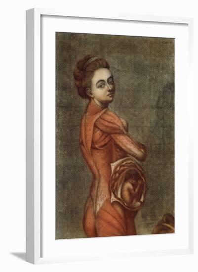 Anatomical Illustration in Colour of a Pregnant Female, 1778-Jacques-Fabien Gautier d'Agoty-Framed Giclee Print