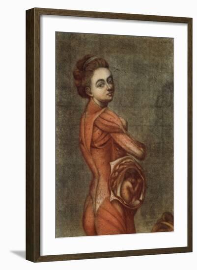 Anatomical Illustration in Colour of a Pregnant Female, 1778-Jacques-Fabien Gautier d'Agoty-Framed Giclee Print