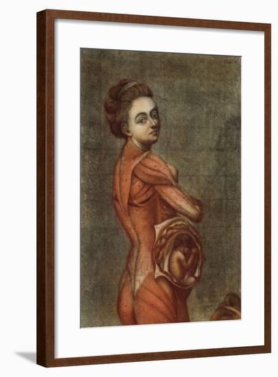 Anatomical Illustration in Colour of a Pregnant Female, 1778-Jacques-Fabien Gautier d'Agoty-Framed Giclee Print