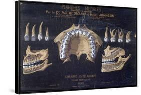 Anatomical Wallchart of the Teeth-null-Framed Stretched Canvas