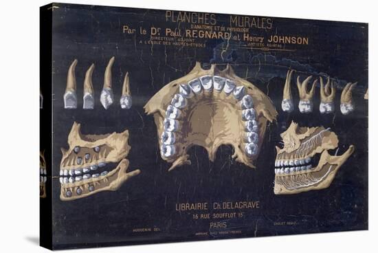 Anatomical Wallchart of the Teeth-null-Stretched Canvas