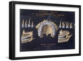 Anatomical Wallchart of the Teeth-null-Framed Giclee Print