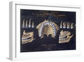 Anatomical Wallchart of the Teeth-null-Framed Giclee Print