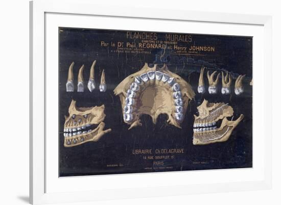 Anatomical Wallchart of the Teeth-null-Framed Giclee Print