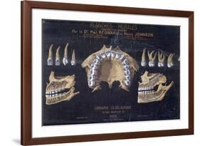 Anatomical Wallchart of the Teeth-null-Framed Giclee Print