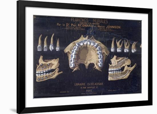 Anatomical Wallchart of the Teeth-null-Framed Giclee Print