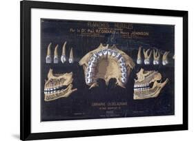 Anatomical Wallchart of the Teeth-null-Framed Giclee Print