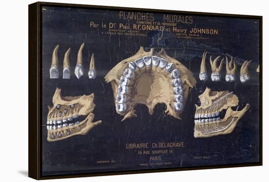 Anatomical Wallchart of the Teeth-null-Framed Stretched Canvas
