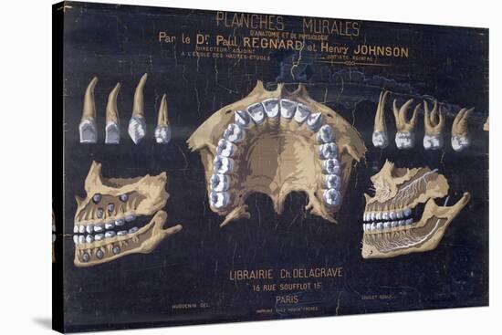 Anatomical Wallchart of the Teeth-null-Stretched Canvas