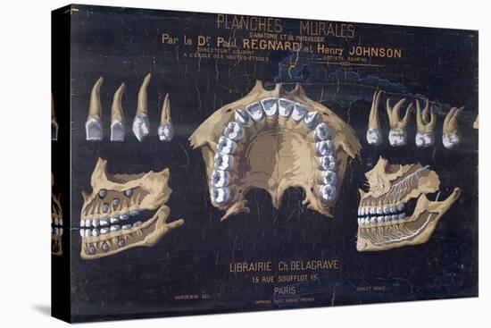 Anatomical Wallchart of the Teeth-null-Stretched Canvas