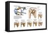 Anatomy of Acromioclavicular Joint Rupture and Displacement-null-Framed Stretched Canvas